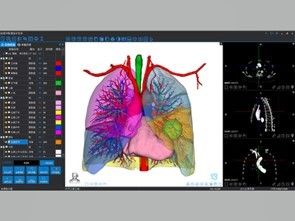 خدمات إعادة بناء 3D الطبية والطباعة 3D